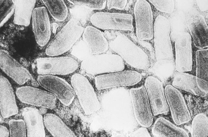 File:Vesicular stomatitis virus (VSV) EM 18 lores.jpg