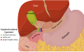 * Nomination: Anatomical drawing - hepatic hilum region --Orem 15:32, 15 August 2013 (UTC) * * Review needed