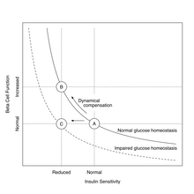 Hyberbolic relationship between insulin sensitivity and beta cell function showing dynamical compensation in „healthy“ insulin resistance (transition from A to B) and the evolution of type 2 diabetes mellitus (transition from A to C).