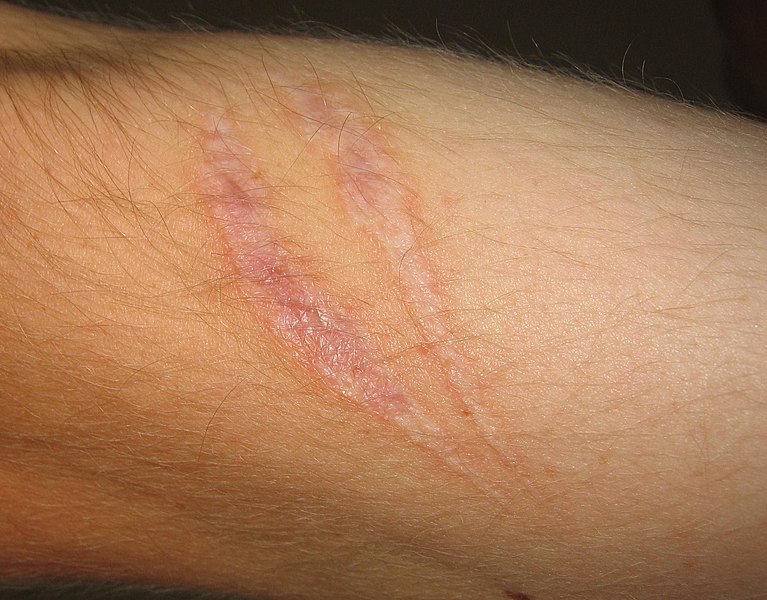 File:Scar (xndr).jpg