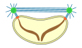 closed extranuclear pleuromitosis