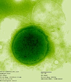 Thermococcus gammatolerans (Euryarchaeota)