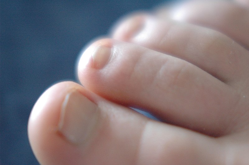 File:Toes.jpg