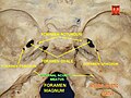 Internal acoustic meatus