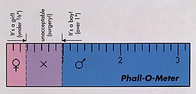 Phall-O-Meter: visuelle Darstellung der Längenunterscheidung von Klitoris und Penis bei Neugeborenen und des sogenannten inakzeptablen Bereichs. Das bedeutet, dass bei einer Länge von mehr als 3/8 und weniger als einem Inch Operationen an den Genitalien angeraten werden.