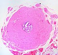 Thumbnail for File:Normal Vas Deferens, Human (3952564123).jpg