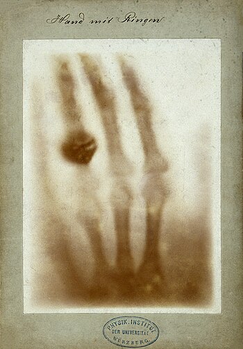 X-ray