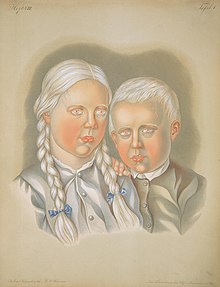 Albino children (8616769222).jpg