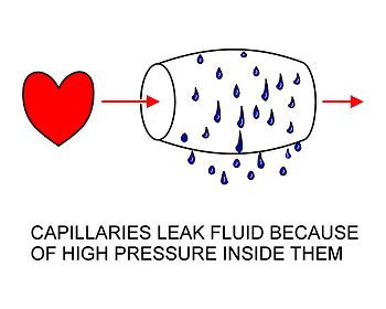 Representación diagramática do movemento da auga saíndo dos capilares cara ao espazo intersticial. A parede capilar é completamente permeable á auga, que é así forzada a saír do capilar cara aos fluídos dos tecidos pola diferenza de presión entre o interior e o exterior do capilar. O capilar móstrase inflado como resultado da presión sanguínea no interior do capilar comparada coa que hai no exterior do capilar. Este inchamento, de feito, non ocorre, pero representouse así para resaltar a forza que causa que a auga abandone os capilares cara aos tecidos.
