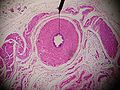 Thumbnail for File:Vas deferens.jpg