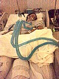 Thumbnail for File:Brisa Alfaro, 32 year old Pons Stroke and Locked In Syndrome Survivor.jpg