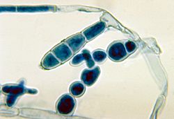 Macroconidia van de schimmel Epidermophyton floccosum de veroorzaker van Tinea cruris