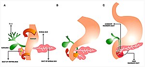 (A) Rotatie van de ventrale knop met de maag en de twaalfvingerige darm naar rechts. (B) De ventrale en dorsale knop fuseren. (C) De hoofdgang van de alvleesklier die via de ventrale knop naar de twaalfvingerige darm gaat. De ventrale knop vormt de processus uncinatus pancreatis en een deel van de kop van de alvleesklier. De dorsale knop vormt de rest van de alvleesklier.