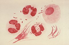 Description de l'image Neisseria gonorrhoeae PHIL 3693 lores.jpg.