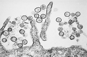 Eletromicrografia de Sin Nombre Virus, membro da família Bunyaviridae.