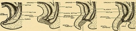 Vier stadia in de ontwikkeling van blaas en rectum in het menselijk embryo. Als gevolg van de achterwaartse groei van een septum wordt de cloacaholte verdeeld in een meer dorsale rectale holte en een ventrale sinus urogenitalis.