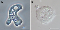 Acanthamoeba sp.