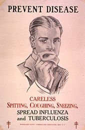 En fransk affisch från cirka 1910-talet (vänster) och en amerikansk affisch från 1920-talet (höger) som båda syftar till att försöka stoppa spridningen av tuberkulos.