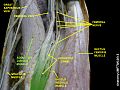 Adductor longus muscle