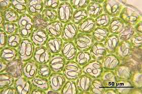 Echt vleugelmos (Nardia scalaris), bladcellen met chloroplasten tegen de celwand en met olielichaampjes, met hoekverdikkingen van celwanden