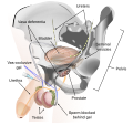 Thumbnail for File:Vas-occlusive Contraception Diagram.svg