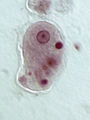 Trofozoit Entamoeba histolytica (Conosa: Archamoebae)