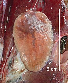 F. magna from liver.jpg