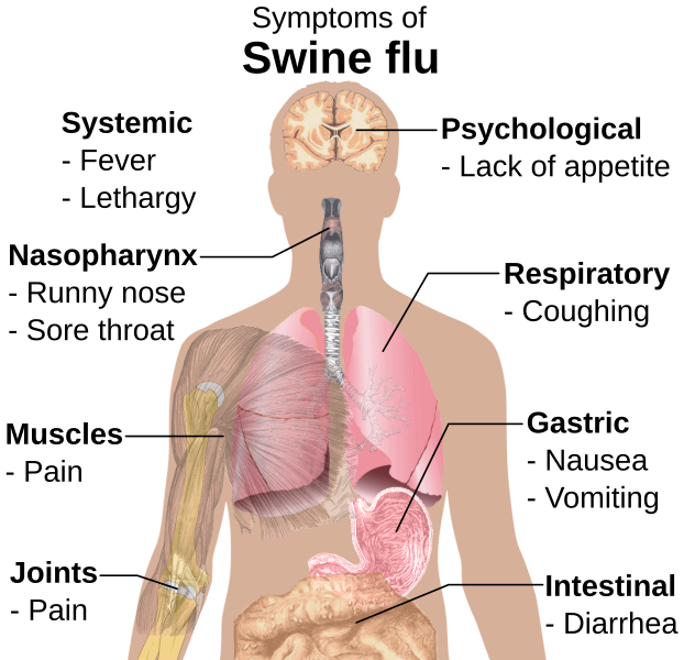 File:Symptoms of swine flu.svg