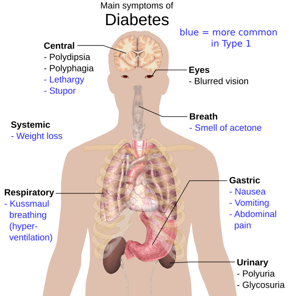 File:Main symptoms of diabetes.svg