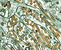 Colorized transmission electron micrograph of Avian influenza A H5N1 viruses (seen in gold) grown in MDCK cells (seen in green).