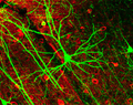 Neurona piramidal visualizada por medio de proteína fluorescente verde (GFP)