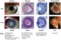 June 28: phenotypes of wild-type (top) and PAX6 ortholog mutations (bottom) in human, mouse, zebrafish, and fly