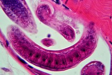 Trichinella spiralis. De grootste larve is ongeveer 22,5 µm lang en ongeveer 5 µm dik.