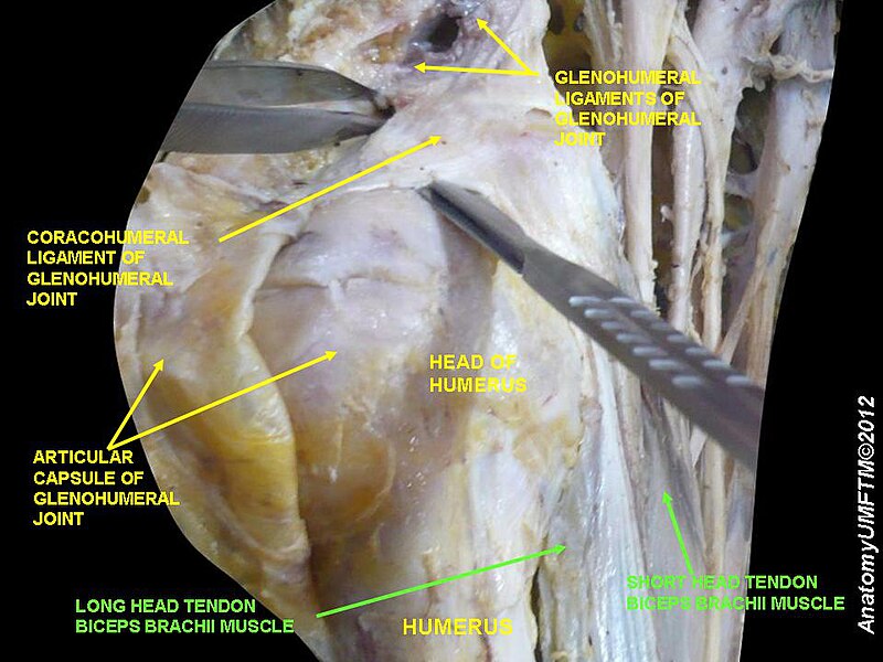 File:Slide3KKKK.JPG