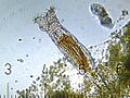   A bdelloid rotifer.