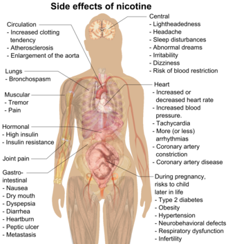 Possible side effects of nicotine include increased clotting tendency, atherosclerosis, enlargement of the aorta, bronchospasm, muscular tremor and pain, gastrointestinal nausea, dry mouth, dyspepsia, diarrhea, heartburn, peptic ulcer, cancer, lightheadedness, headache, sleep disturbances, abnormal dreams, irritability, dizziness, blood restriction, increased or decreased heart rate, increased blood pressure, tachycardia, more (or less) arrhythmias, coronary artery constriction, coronary artery disease, high insulin, insulin resistance, and risks to child later in life during pregnancy include type 2 diabetes, obesity, hypertension, neurobehavioral defects, respiratory dysfunction, and infertility.