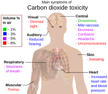 Diagram of the upper human body with callouts naming the symptoms that affect different parts of the body.