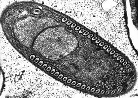 Esporoblasto de Fibrillanosema crangonycis.