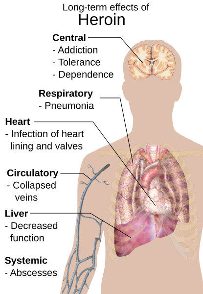 File:Long-term effects of heroin.svg