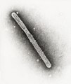 This transmission electron micrograph (TEM), taken at a magnification of 150,000x, revealed the ultrastructural details of an avian influenza A (H5N1) virion, a type of bird flu virus which is a subtype of avian influenza A.