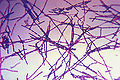 Bacillus anthracis