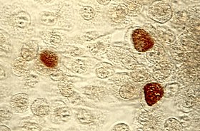 Chlamydia trachomatis