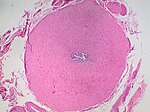 Thumbnail for File:Histology of vas deferens.jpg