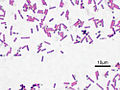 Bacillus subtilis