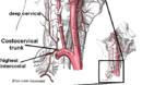 Costocervical trunk