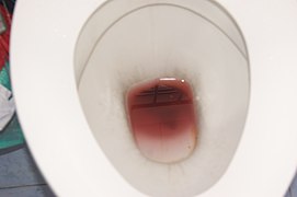 Reddish stool in toilet bowl water due to dragon fruit consumption.jpg