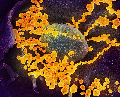 Severe acute respiratory syndrome coronavirus 2