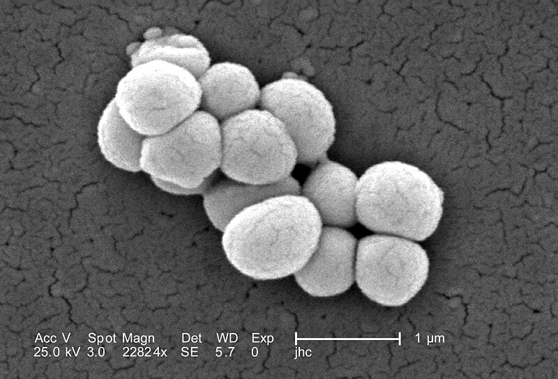 File:Micrococcus luteus 9759.jpeg