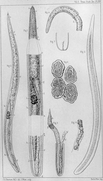 Fig. 1. Trichinella spiralis. a a a cuticula; b b b. spierlaag; c mond; d, anus; e. slokdarm; f f. spijsverteringskanaal; g. trechtervormig gedeelte, met peervormige lichamen aan de basis; h. kanaal verbonden met voortplantingsproces; i. gele afzetting erin; j j. ruimte tussen spierlaag en inwendige delen ervan. Het eindigt hierboven in kleine puntjes. Fig. 8 Dwarsdoorsneden rondworm