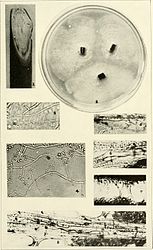 Sporothrix stadium van Ophiostoma ulmi: 4. Conidioforen met conidia